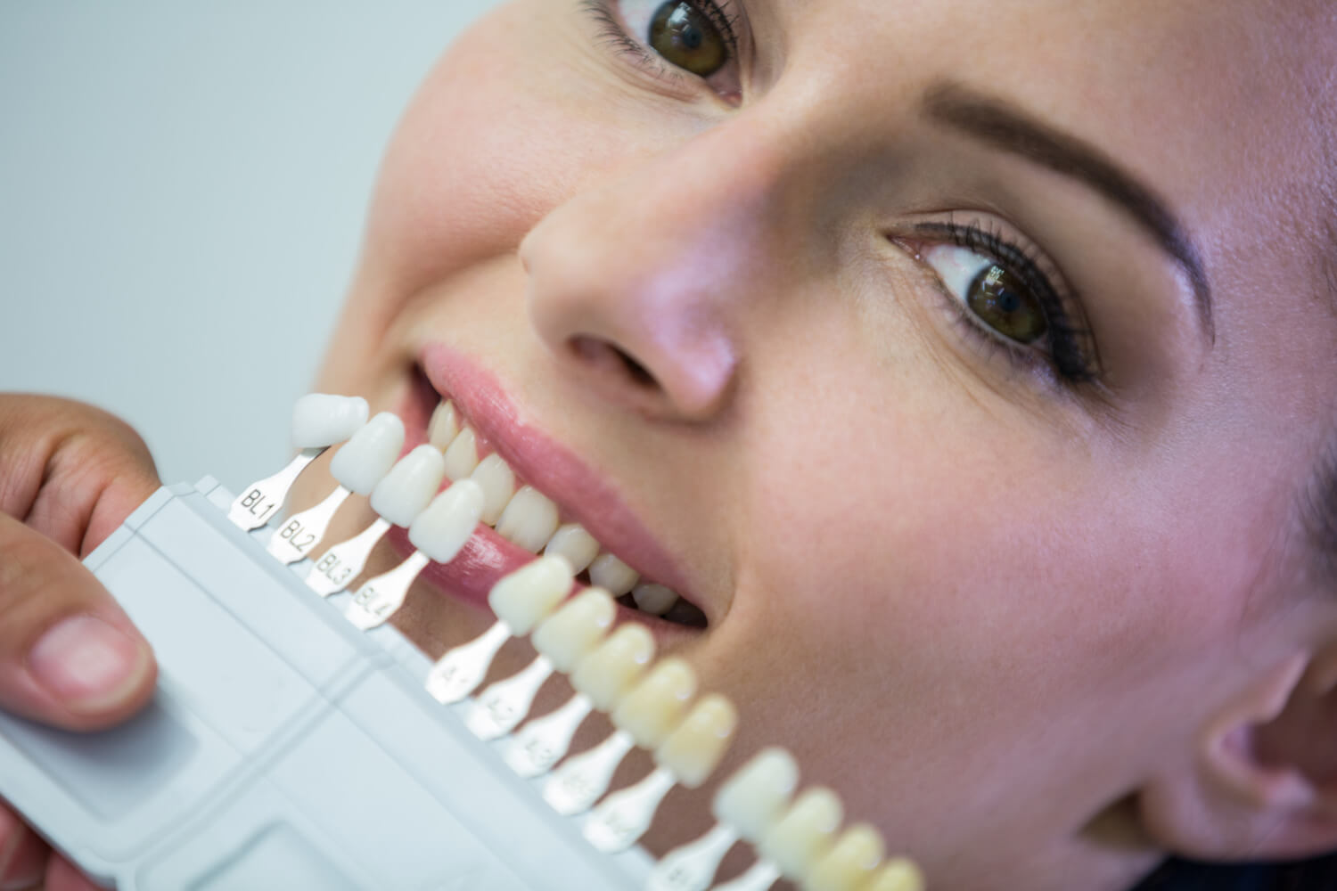 Lentes de Contato Estragam os Dentes Naturais? Descubra a Verdade em São Caetano do Sul
